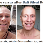 Antes versus después de Bali Silent Retreat